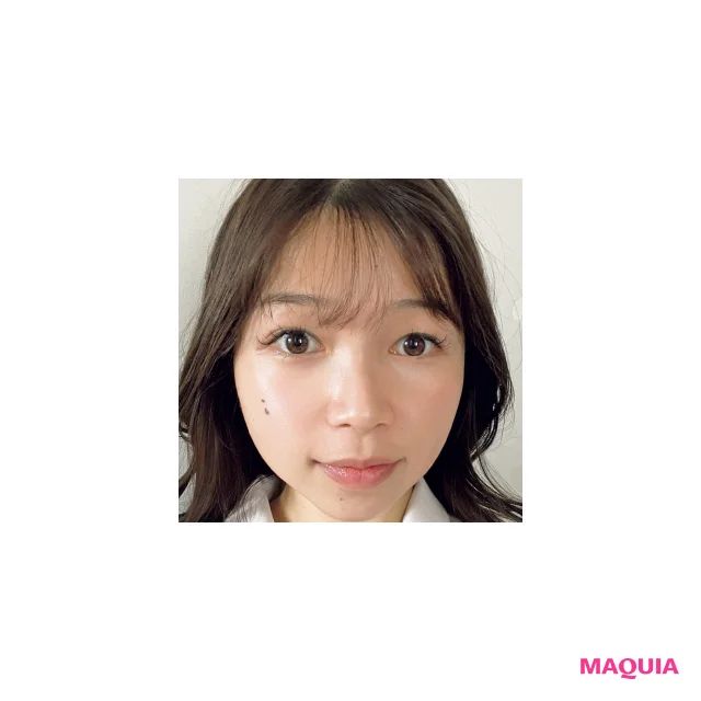 額ニキビの原因は手厚すぎるケアだった!? 友利 新先生が指南する“引き算”スキンケア_3