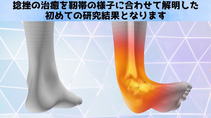 痛み消失＝完治？その思い込みが再発を呼ぶ