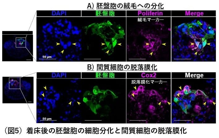 試験管から始まる妊娠革命