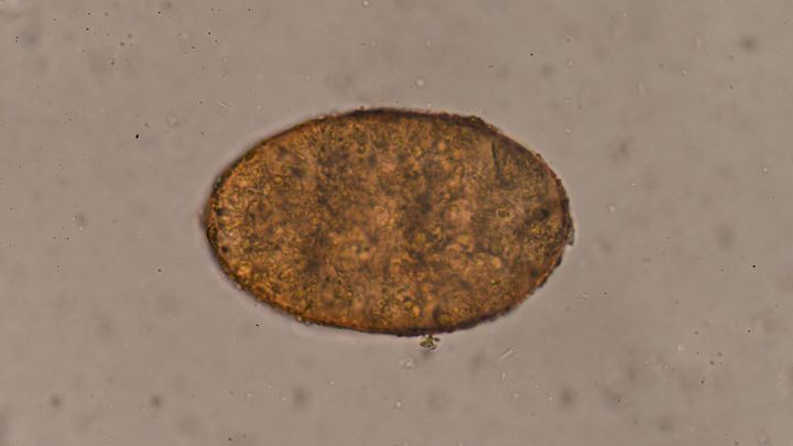 「ヒトの細胞の皮を被ったバケモノ」の真実