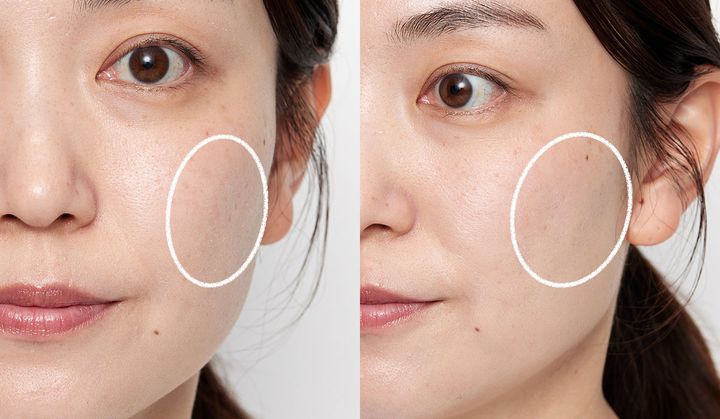 がっつりコケてはいないけれど“顔の影”を消し去りたい！