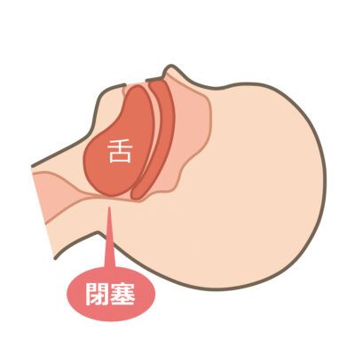 【いびき】を自力で止める対策方法！原因別いびきグッズ6選！【睡眠専門医 監修】