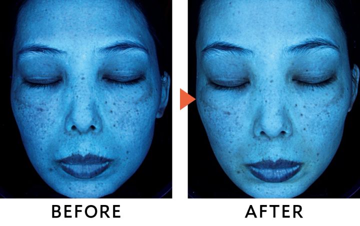 エリクシール デーケアレボリューション ブライトニング + ba 口コミ