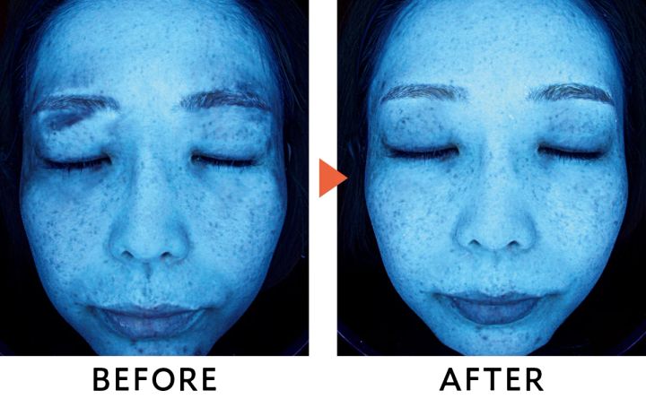 ポーラ ホワイトショット セラムUV 口コミ