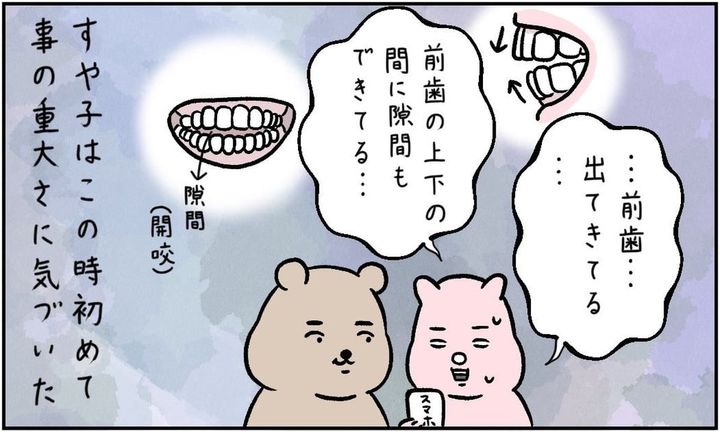 漫画「ナイトガードで開咬になった（かもしれなくて）矯正することになった話」のカット（すやすや子さん提供）