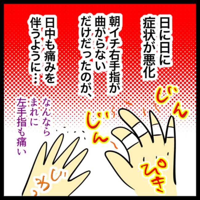 手指のこわばり／へそ