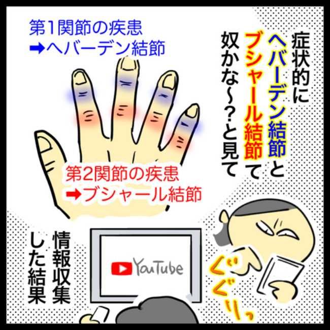 手指のこわばり／へそ