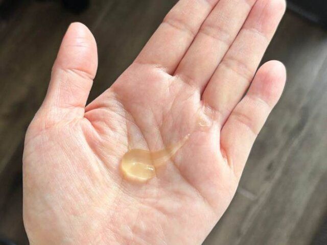 レチノールやビタミンCなど攻めの成分は要検討