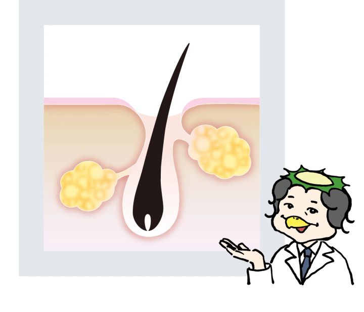 【開き毛穴の改善に】おすすめのスキンケアアイテム26選！毛穴が開く原因も解説_3