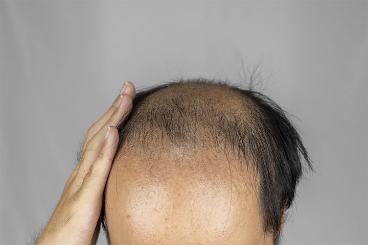 頭髪を気にする40代男性のイメージ