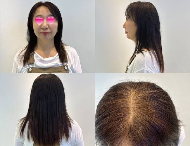 薄毛が気になる女性