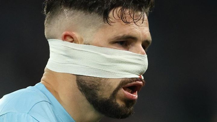 日本代表と対戦する豪州、顔面キックで鼻骨骨折の34歳英雄が離脱へ…流血もプレー続行で優勝に貢献