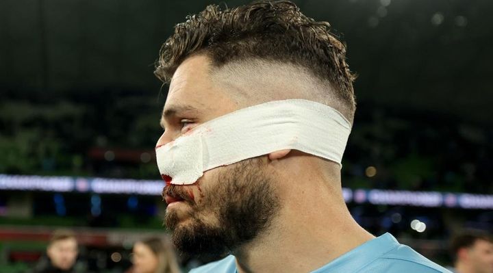 日本代表と対戦する豪州、顔面キックで鼻骨骨折の34歳英雄が離脱へ…流血もプレー続行で優勝に貢献