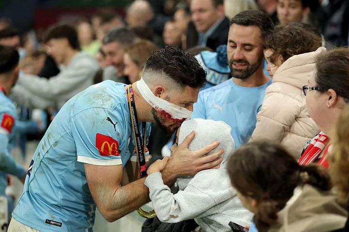 日本代表と対戦する豪州、顔面キックで鼻骨骨折の34歳英雄が離脱へ…流血もプレー続行で優勝に貢献