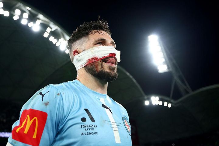 日本代表と対戦する豪州、顔面キックで鼻骨骨折の34歳英雄が離脱へ…流血もプレー続行で優勝に貢献