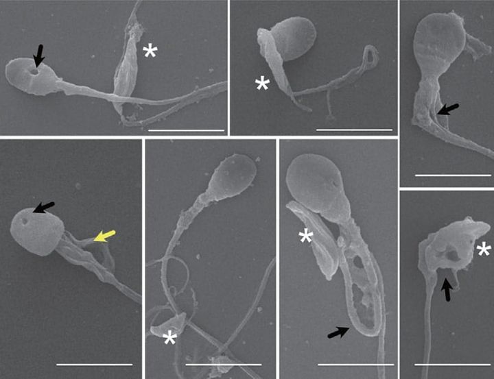 5分で起きた“首切り”ショック