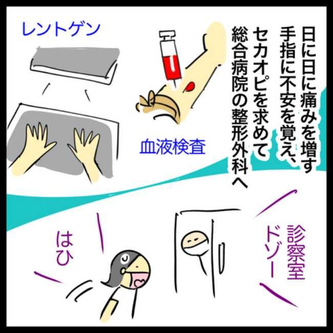 手指のこわばり／へそ