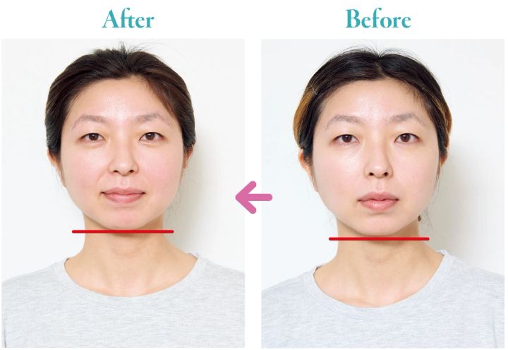 【セルフで簡単！】小顔マッサージのやり方を気になる悩み別に5つご紹介_27