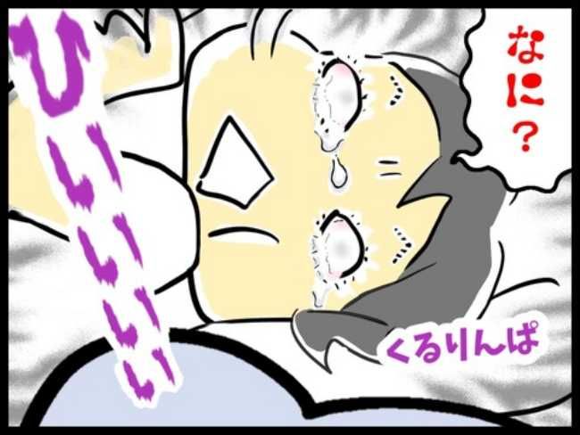 緑内障ダイアリー／へそ