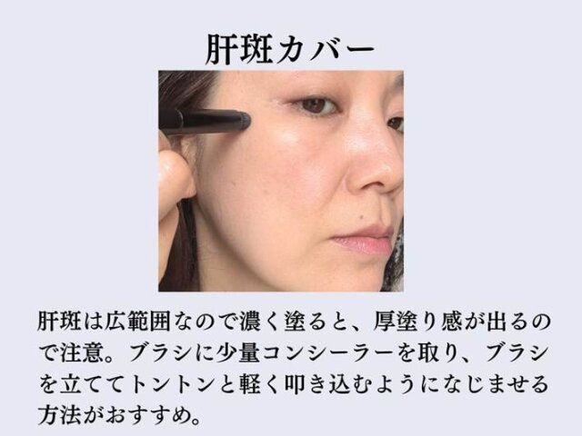 肝斑カバー 解説