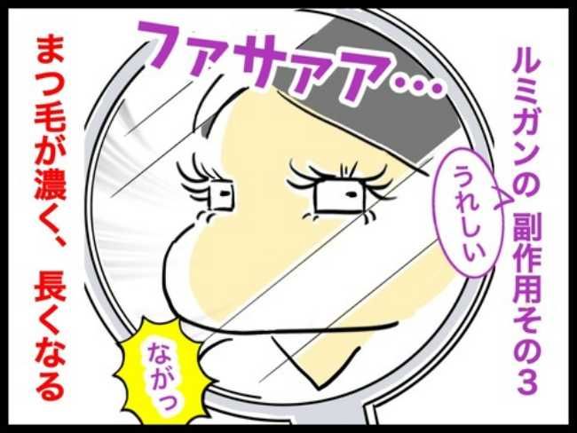 緑内障ダイアリー／へそ