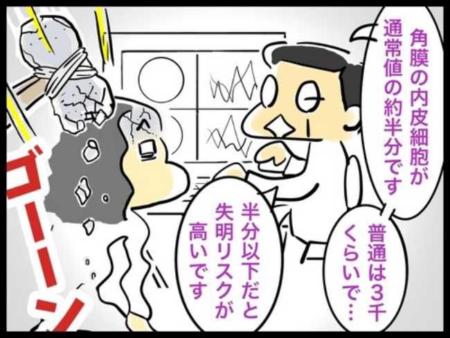 緑内障ダイアリー／へそ