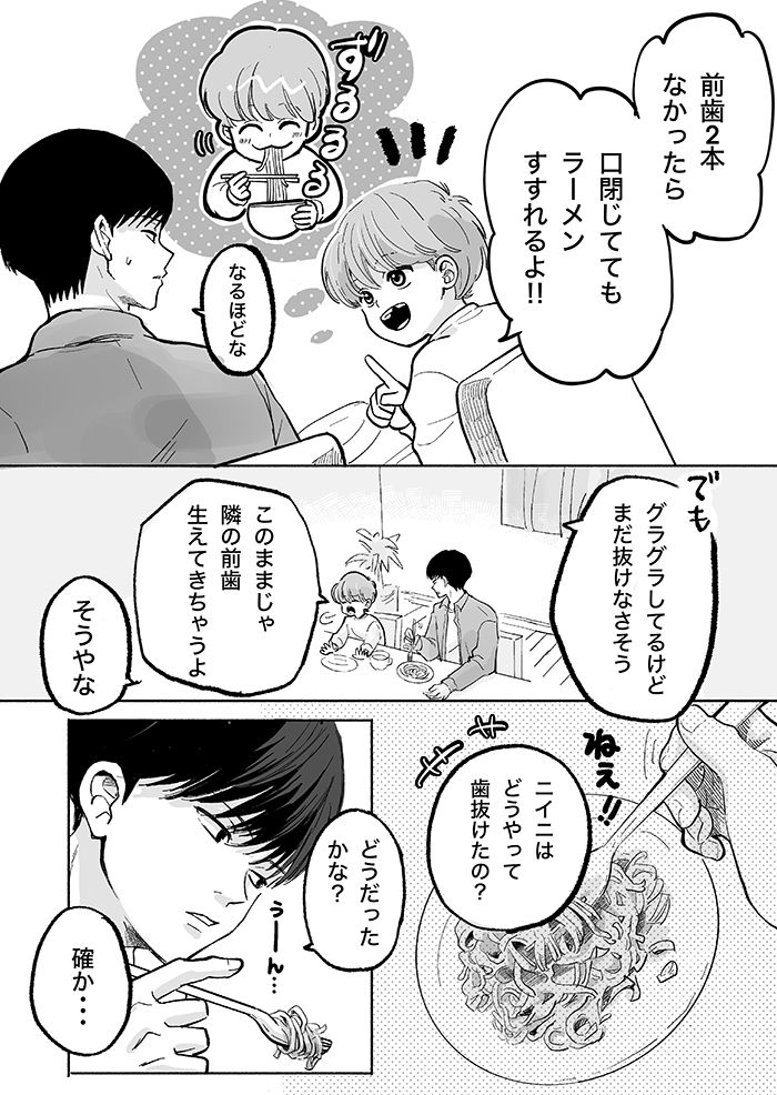 「ニイニはどうやって歯抜けたの？」「どうだったかな、確か…」前歯が抜けたときのこと【ぼくのニイニは高校生・39】の画像4