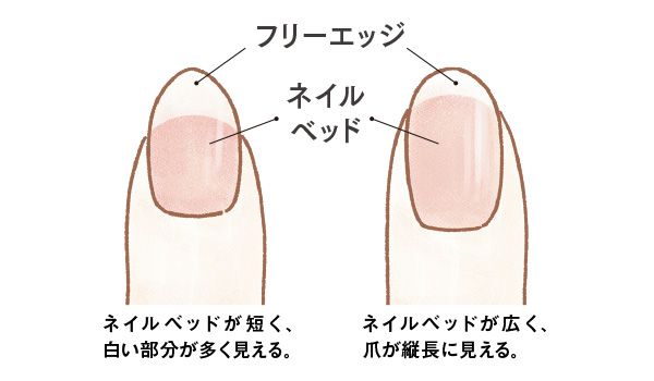 ネイルベッドが短く、白い部分が多く見えるタイプ。ネイルベッドが広く、爪が縦長に見えるタイプ。