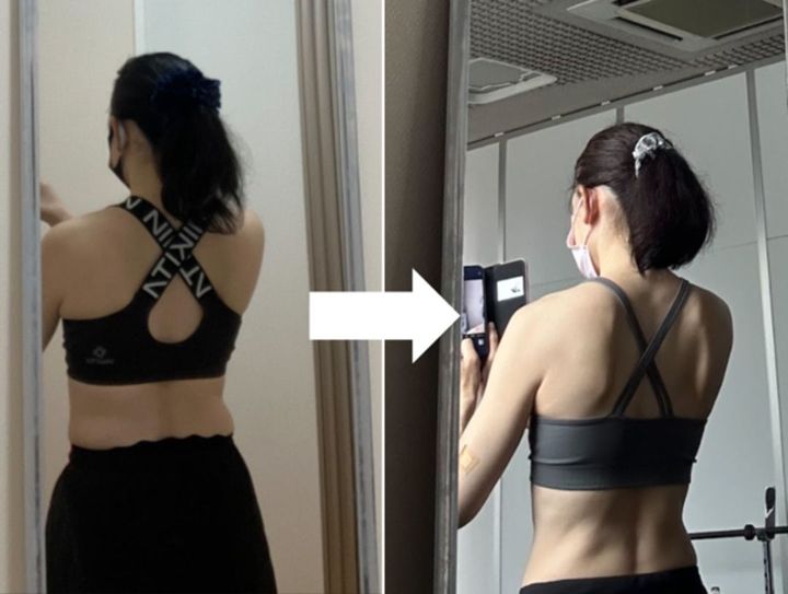 ダイエット後は丸かった背中がシャープになった