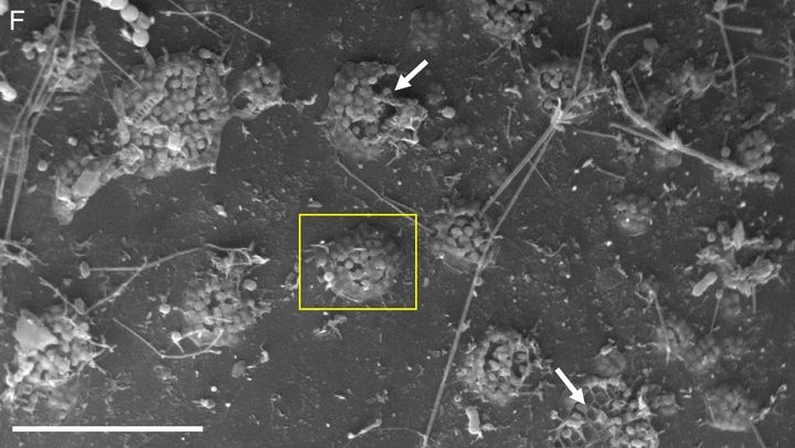 温室効果ガスを“養殖”して食べる――深海クモの衝撃エコ戦略