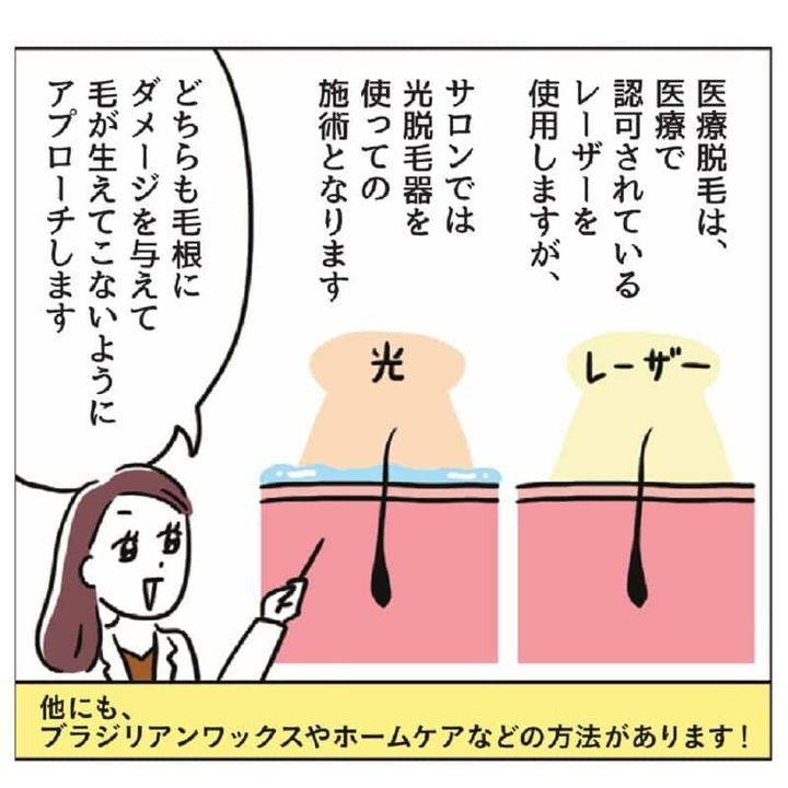 更年期のVIO脱毛 レーザーと光治療の解説