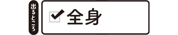 温熱性発汗 【出るところ】全身