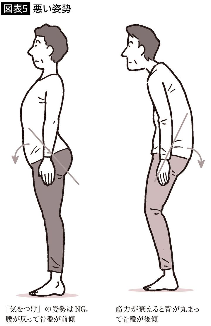 【図表5】悪い姿勢