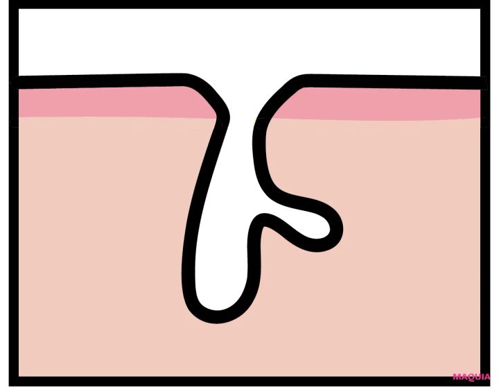 「乾燥による開き毛穴」は最新コスメで応戦！ 洗顔・美容液・クリームのおすすめをチェック_3