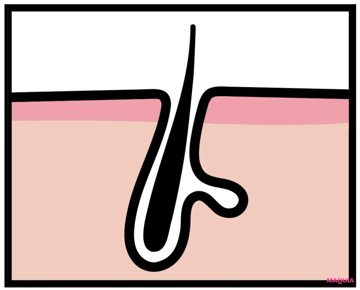 「頑固な黒ずみ毛穴」のおすすめ成分、NGケアをレクチャー。なかなか落ちない場合は産毛の可能性も？_5