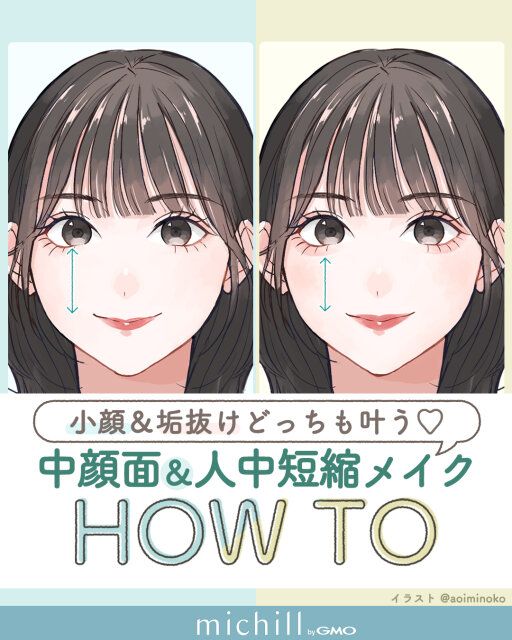 中顔面と人中短縮を実現して小顔も垢抜けも叶える