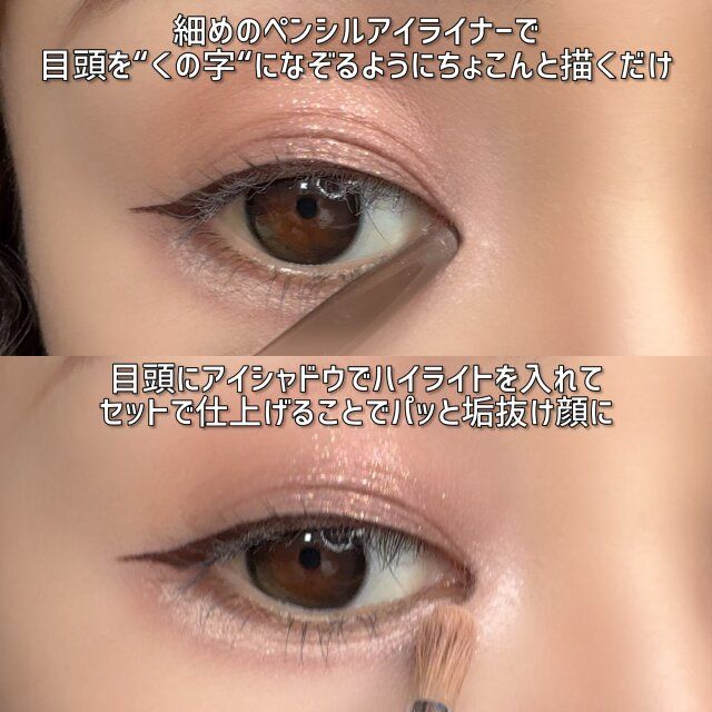 目頭の切開ライン 入れ方