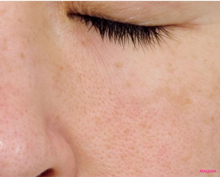 皮脂過多による「開き毛穴」に効くお手入れは？ ビタミンC＆摩擦レスの“攻めないケア”が正解_9_2