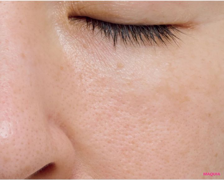 皮脂過多による「開き毛穴」に効くお手入れは？ ビタミンC＆摩擦レスの“攻めないケア”が正解_9_1