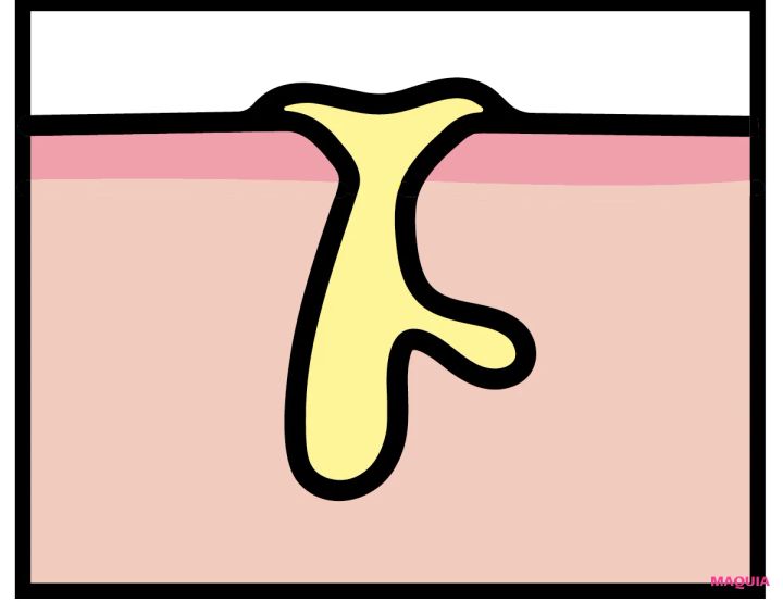 皮脂過多による「開き毛穴」に効くお手入れは？ ビタミンC＆摩擦レスの“攻めないケア”が正解_3