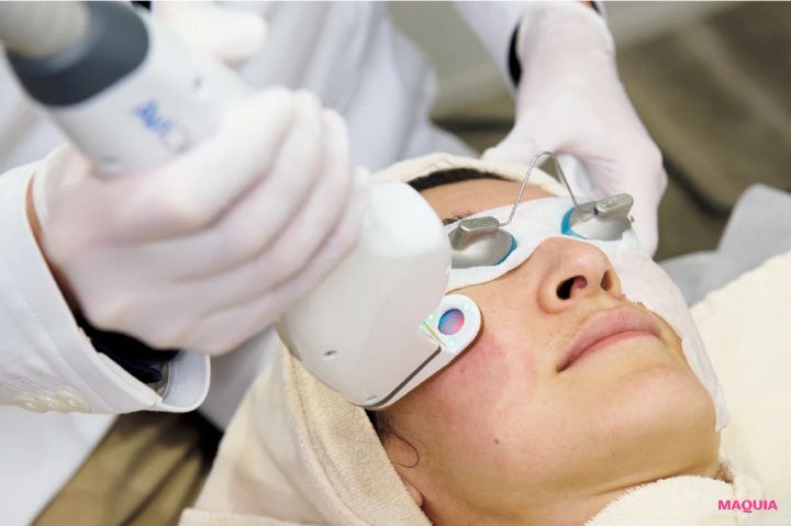 皮脂過多による「開き毛穴」に効くお手入れは？ ビタミンC＆摩擦レスの“攻めないケア”が正解_8