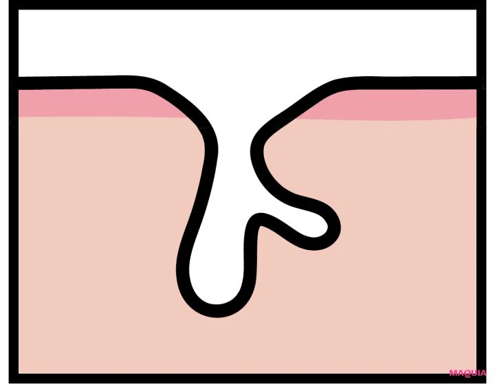 エイジングによる「たるみ毛穴」は、マッサージ&最新コスメでお手入れを。話題の「ジュベルック」体験記も_3