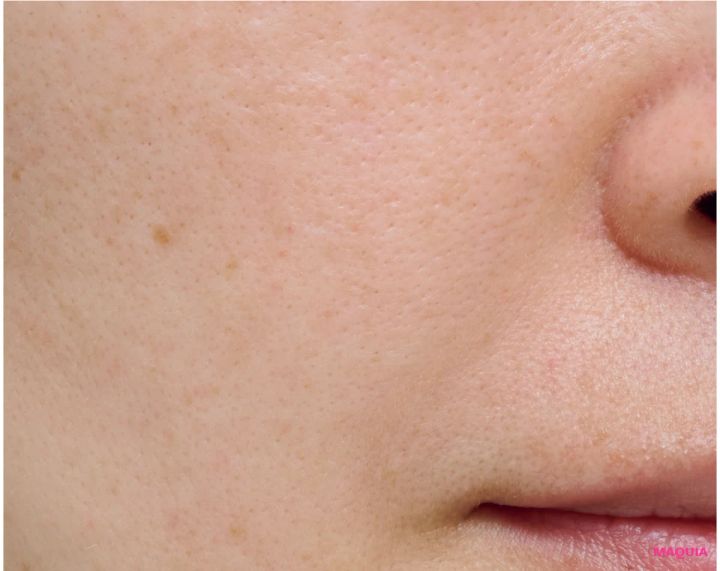 エイジングによる「たるみ毛穴」は、マッサージ&最新コスメでお手入れを。話題の「ジュベルック」体験記も_9_1