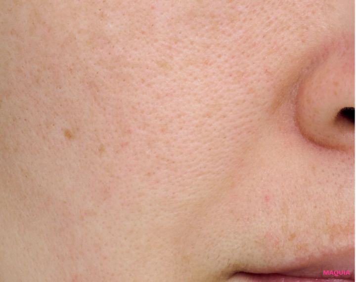 エイジングによる「たるみ毛穴」は、マッサージ&最新コスメでお手入れを。話題の「ジュベルック」体験記も_9_2