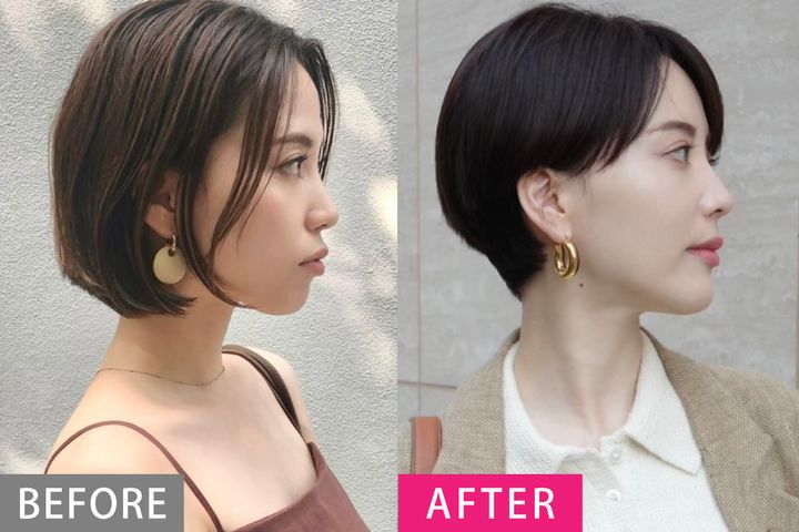 【歯列矯正の体験談】「歯がキレイな人」に聞く、クリニック選びのコツ・やってよかったこと・後悔したこと