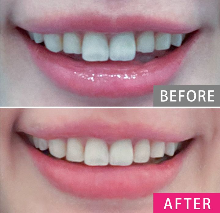 【歯列矯正の体験談】「歯がキレイな人」に聞く、クリニック選びのコツ・やってよかったこと・後悔したこと