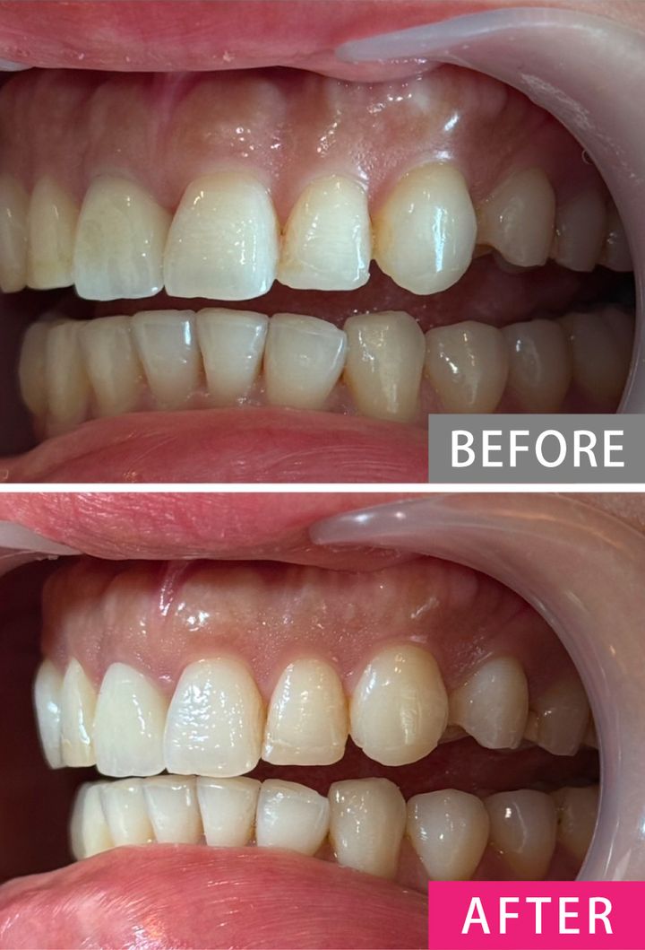 【歯列矯正の体験談】「歯がキレイな人」に聞く、クリニック選びのコツ・やってよかったこと・後悔したこと