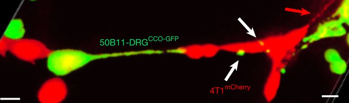 がん細胞は隣の神経から『エネルギー工場』を奪っていた