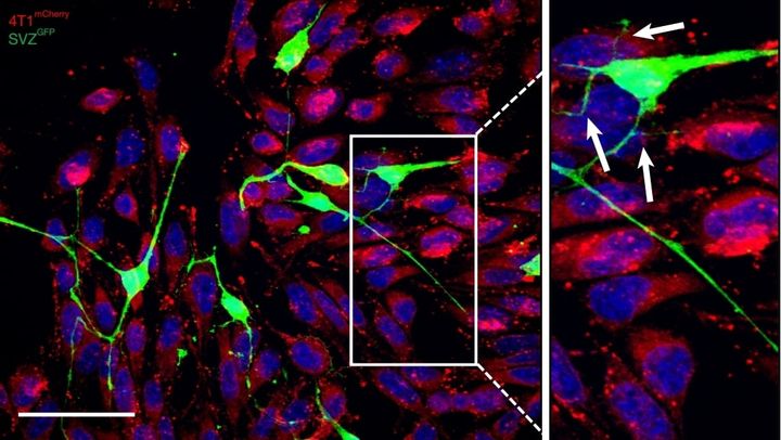 がんの『転移能力』を支えるのは何か？