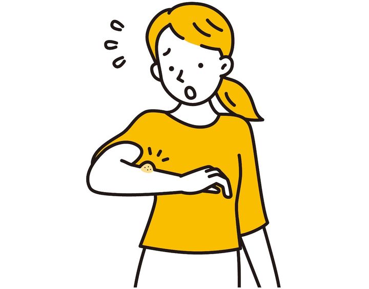 腕を蚊に刺されてしまった女性のイラスト